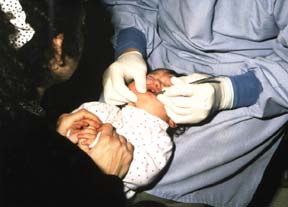 dental exam