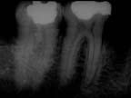xray