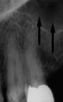 xray