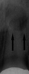 xray