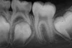 xray