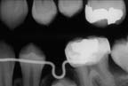 xray