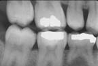 xray