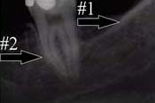 xray1