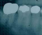 xray