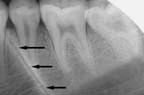 xray
