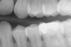 xray