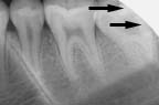 xray