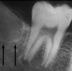 xray