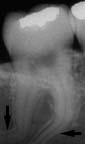 xray