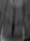 xray