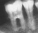 xray