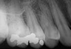 xray