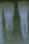 xray