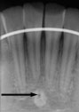 xray