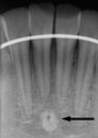 xray