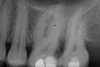 xray
