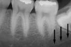 xray