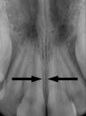 xray