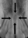 xray