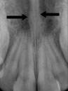 xray