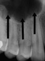 xray