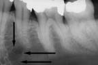 xray