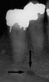 xray