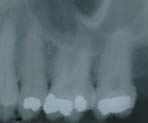 xray