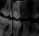 xray