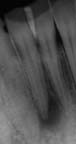 xray