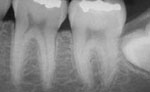 xray