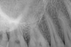 xray
