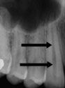 xray