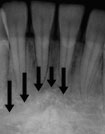 xray