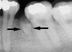 xray