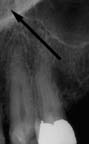 xray