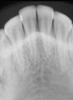 xray