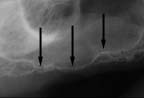 xray