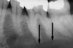 xray