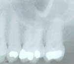 xray