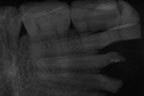 xray