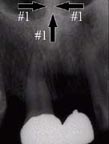 xray