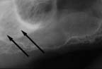 xray