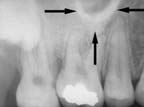 xray