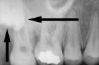 xray