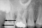 xray