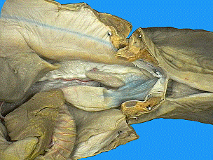 Untitled Document [www.pc.maricopa.edu] stomach diagram labelled 